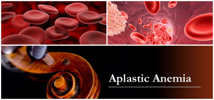 Aplastic-anemia – chandigarh cancer & diagnostic center